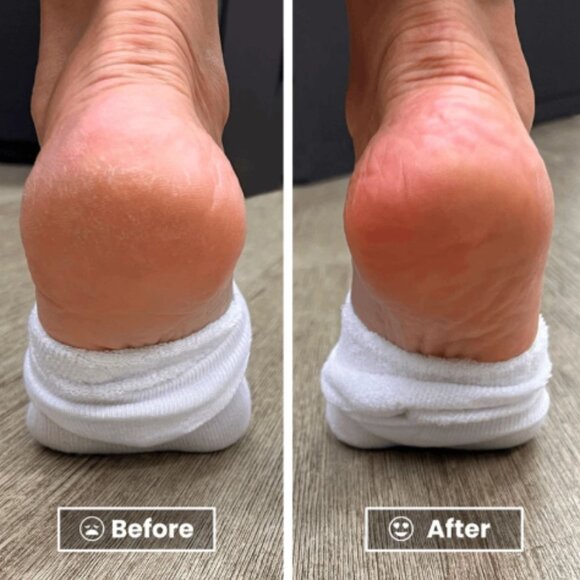 New never used Londontown INC. Foot Balm - Picture 3 of 4